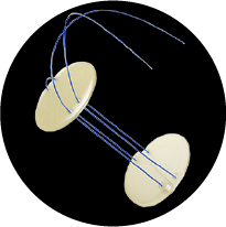 Craniofixation.png Craniofixation.png